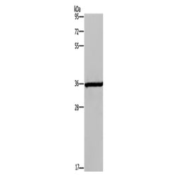 DIO2 rabbit polyclonal antibody