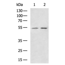 GCGR rabbit polyclonal antibody