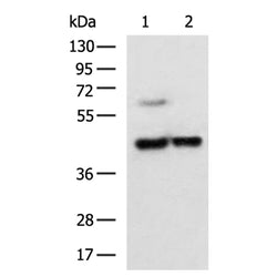 GPAT3 rabbit polyclonal antibody