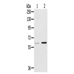 ME1 rabbit polyclonal antibody
