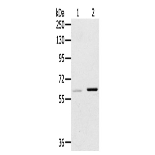 ME1 rabbit polyclonal antibody