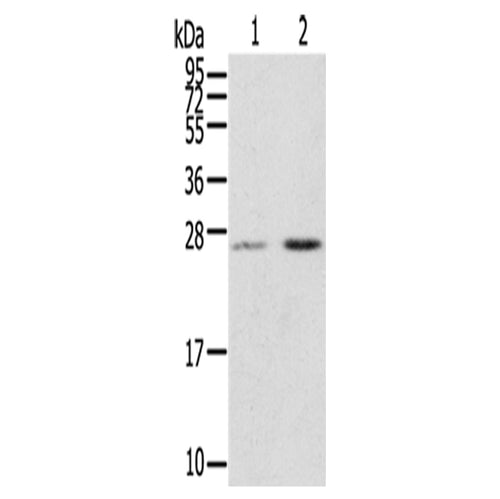MIG7 rabbit polyclonal antibody