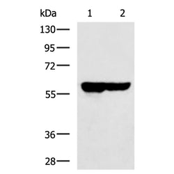 SLC22A12 rabbit polyclonal antibody