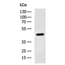 P2RY2 rabbit polyclonal antibody