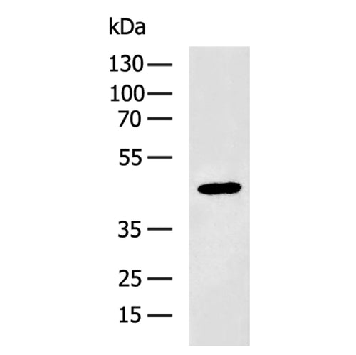 P2RY2 rabbit polyclonal antibody