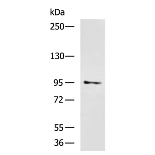 PDCD6IP rabbit polyclonal antibody
