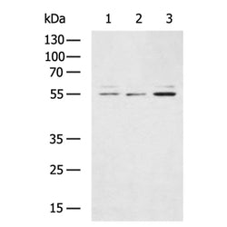 RORB rabbit polyclonal antibody