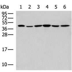 SYCP3 rabbit polyclonal antibody
