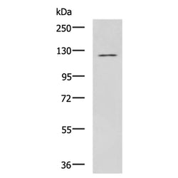 SEMA6D rabbit polyclonal antibody