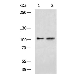 SEZ6L rabbit polyclonal antibody