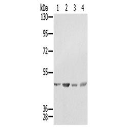 SSB rabbit polyclonal antibody