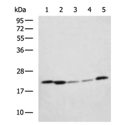 STARD4 rabbit polyclonal antibody