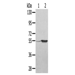 TRIM35 rabbit polyclonal antibody
