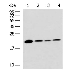 TREM2 rabbit polyclonal antibody