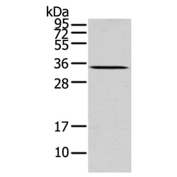 UCP2 rabbit polyclonal antibody