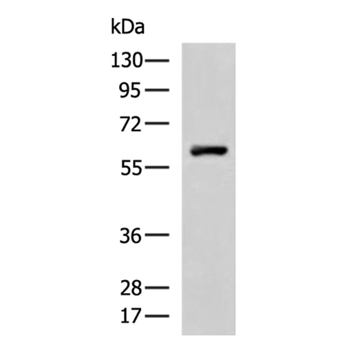 PPARG rabbit polyclonal antibody