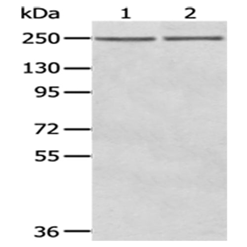 WNK2 rabbit polyclonal antibody