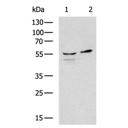 ENTPD1 rabbit polyclonal antibody