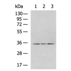 CDX2 rabbit polyclonal antibody
