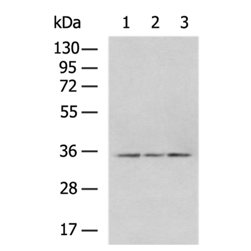 CDX2 rabbit polyclonal antibody