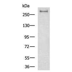 FASN rabbit polyclonal antibody