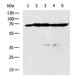 E2F1 rabbit polyclonal antibody