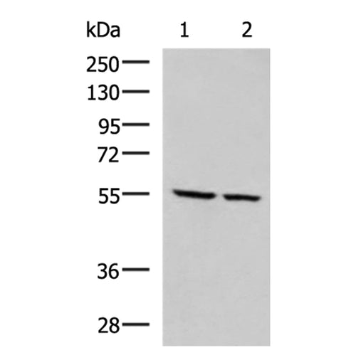 ECM1 rabbit polyclonal antibody