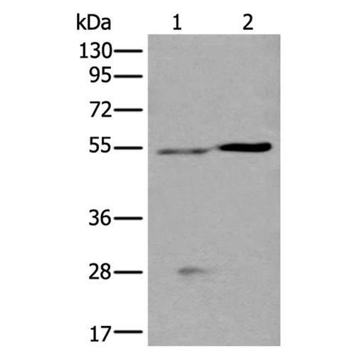DDC rabbit polyclonal antibody