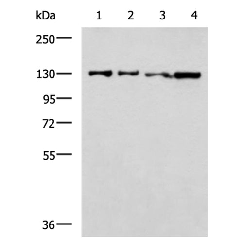 SLC4A3 rabbit polyclonal antibody