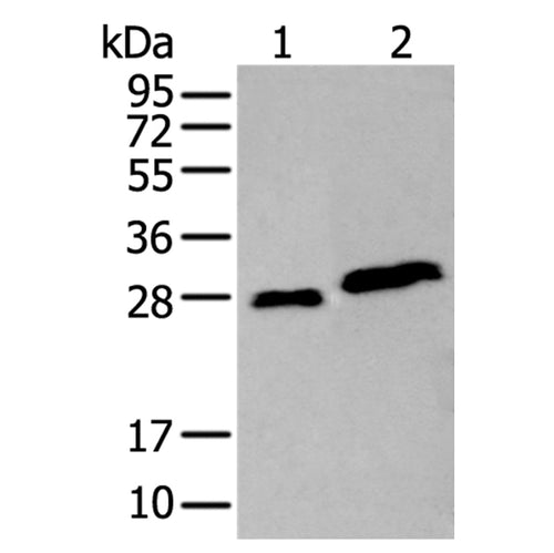 AK4 rabbit polyclonal antibody