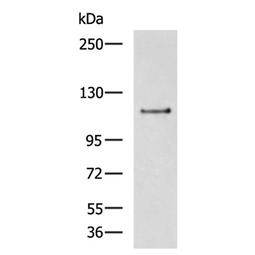 GLI1 rabbit polyclonal antibody