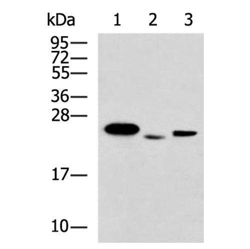 ARHGDIB rabbit polyclonal antibody