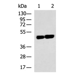 CNP rabbit polyclonal antibody