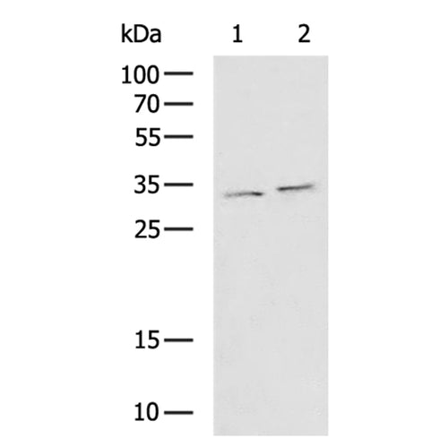 HOXC4 rabbit polyclonal antibody