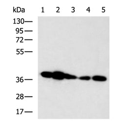 HOXD3 rabbit polyclonal antibody