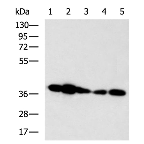 HOXD3 rabbit polyclonal antibody