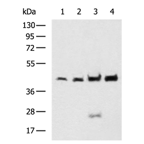 DSCC1 rabbit polyclonal antibody