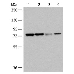 DYRK1A rabbit polyclonal antibody