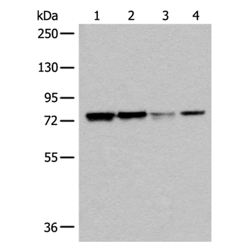 DYRK1A rabbit polyclonal antibody
