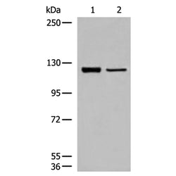CLIP2 rabbit polyclonal antibody