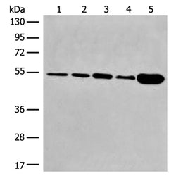 DYNC1LI2 rabbit polyclonal antibody