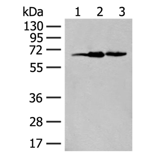 EXOSC9 rabbit polyclonal antibody