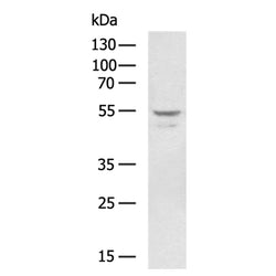 ACOD1 rabbit polyclonal antibody