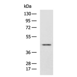 FCGRT rabbit polyclonal antibody