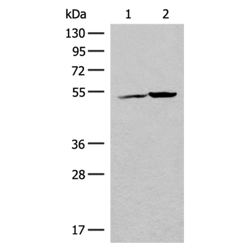 FECH rabbit polyclonal antibody