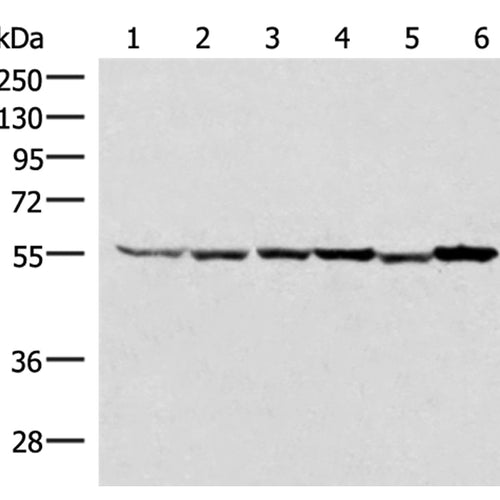 RUVBL1 rabbit polyclonal antibody