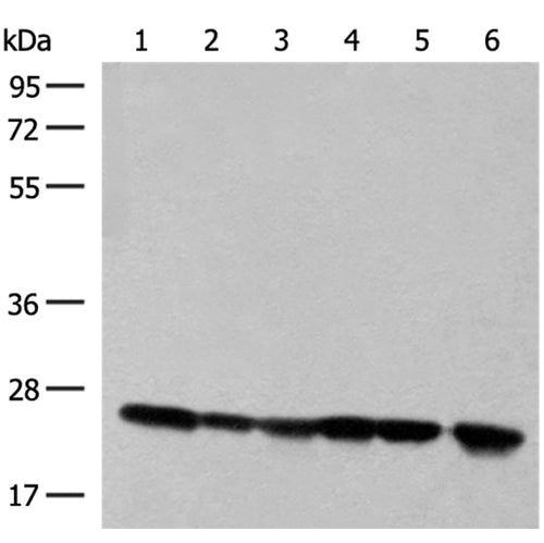 DTYMK rabbit polyclonal antibody