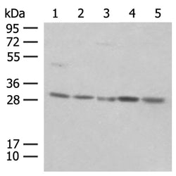 PSMA4 rabbit polyclonal antibody