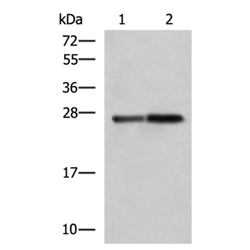 CTRB1 rabbit polyclonal antibody