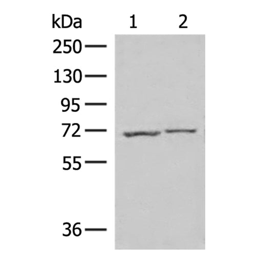 ECD rabbit polyclonal antibody